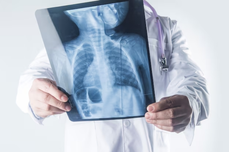 X-Ray